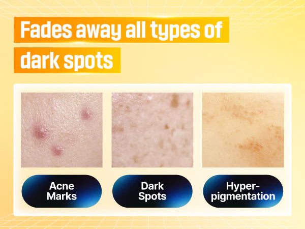 Numaura 7+ Fades away all types of dark spots, acne marks and hyperpigmentation